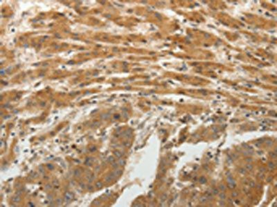 SPATA17 Antibody
