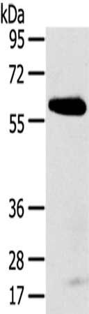 SPATA18 Antibody