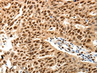 SPATA2L Antibody