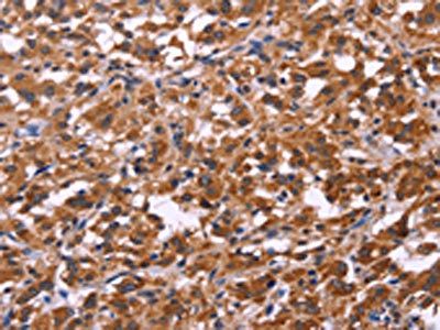 SPATA7 Antibody