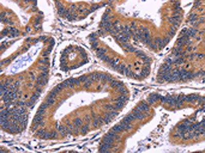 SPATA7 Antibody