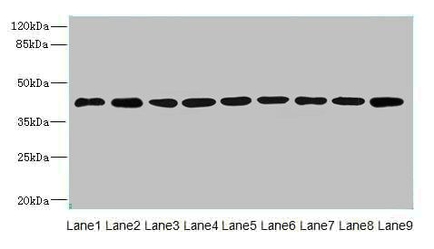 SH3GLB2 Antibody
