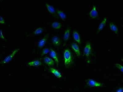 SPCS2 Antibody