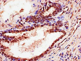 SPDEF Antibody