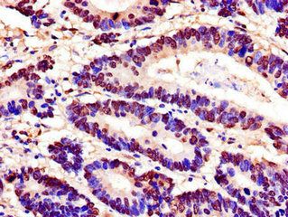 SPDEF Antibody