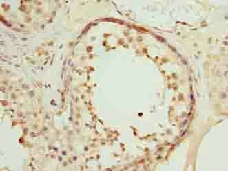 SPDL1 Antibody