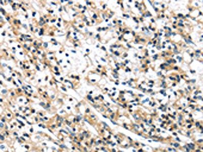 SPDL1 Antibody