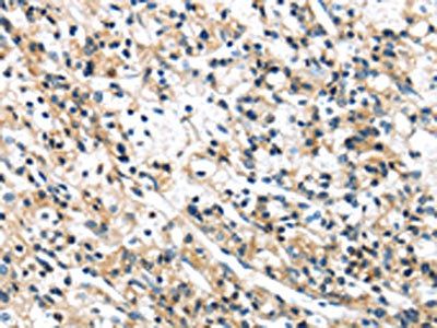 SPDL1 antibody