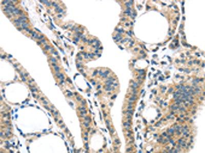 SPDL1 Antibody