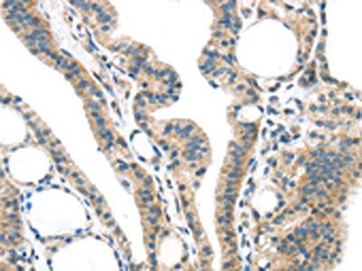 SPDL1 antibody