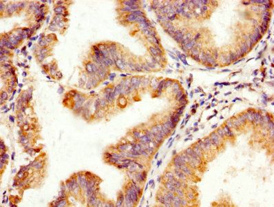 SPA17 Antibody
