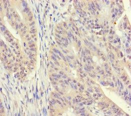 Spermidine synthase antibody