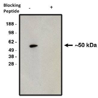 Rabbit Human Sphingomyelin Phosphodiesterase 3 Antibody