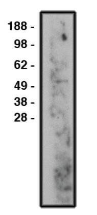 Rabbit Human Sphingomyelin Phosphodiesterase 3 Antibody