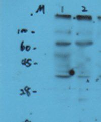 Sphingomyelin Synthase 1 antibody