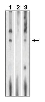Rabbit anti Human Sphingosine 1 Phosphate  Receptor 1 (EDG-1) CT Antibody