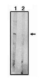 Rabbit Human Sphingosine 1 Phosphate Receptor 5 CT (EDG-8) Antibody
