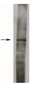 Rabbit anti Rat Sphingosine Kinase 1, Long Form Antibody