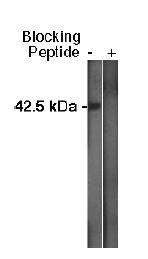 Rabbit Human Sphingosine Kinase 1 Antibody