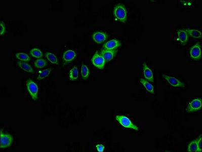 SPHK1 Antibody