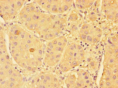SPHK1 Antibody