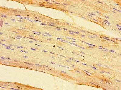 SPHK1 Antibody