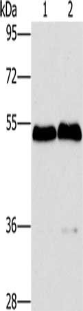 SPHK2 Antibody