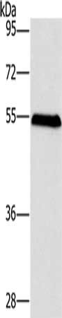 SPHK2 Antibody