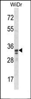 SPI1 antibody