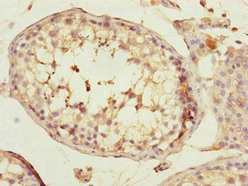 SPICE1 Antibody