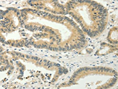 SPIN4 Antibody