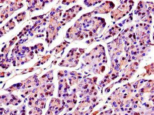 SPINK1 Antibody