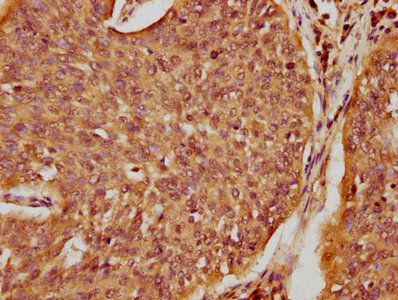 SPINK5 Antibody