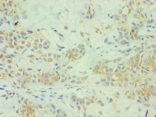 SPINT1 Antibody