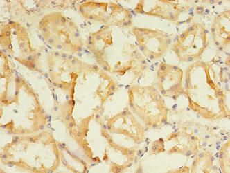 SPIRE2 Antibody