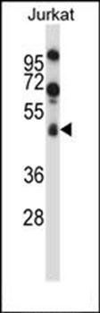 SPN/CD43 antibody