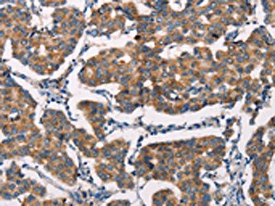 SPR Antibody