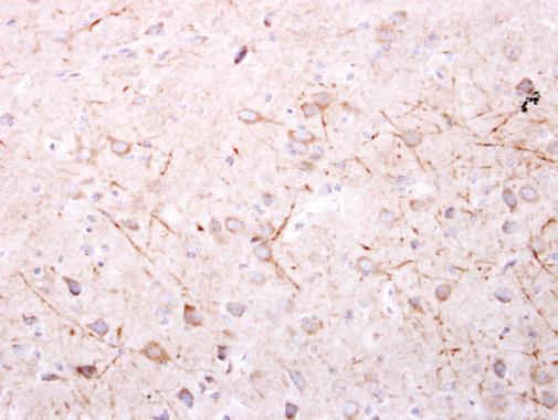 SPR antibody [N2C3]