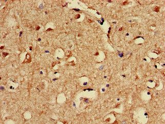 SPRED1 Antibody