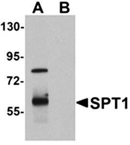 SPT1 Rabbit Polyclonal Antibody