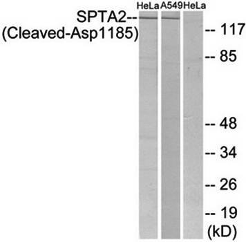 SPTA2 (Cleaved-Asp1185) Antibody