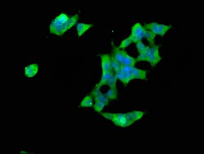 SPTBN1 Antibody