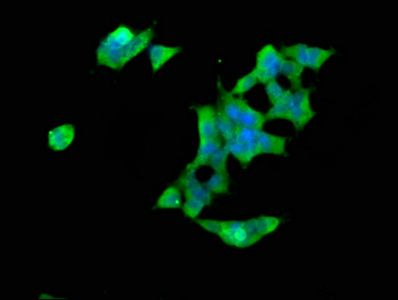 SPTBN1 antibody