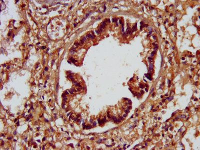 SPTBN1 Antibody