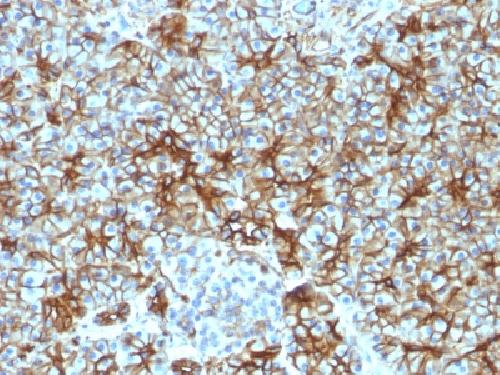 SPTBN2 Antibody