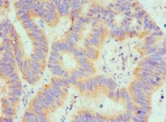 SPTLC1 Antibody