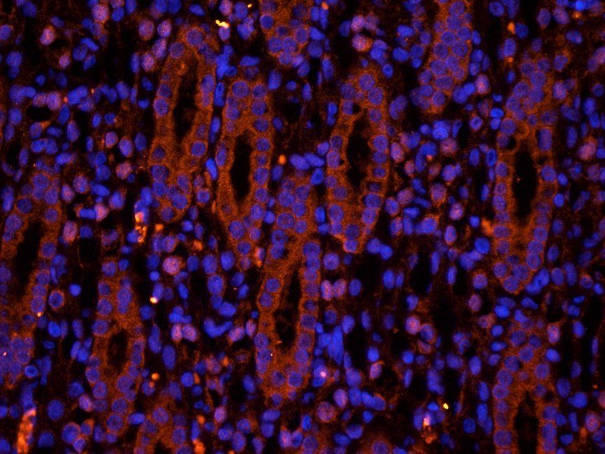 SRBP2 antibody