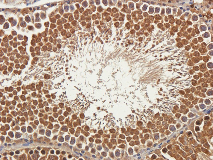 SRBP2 antibody