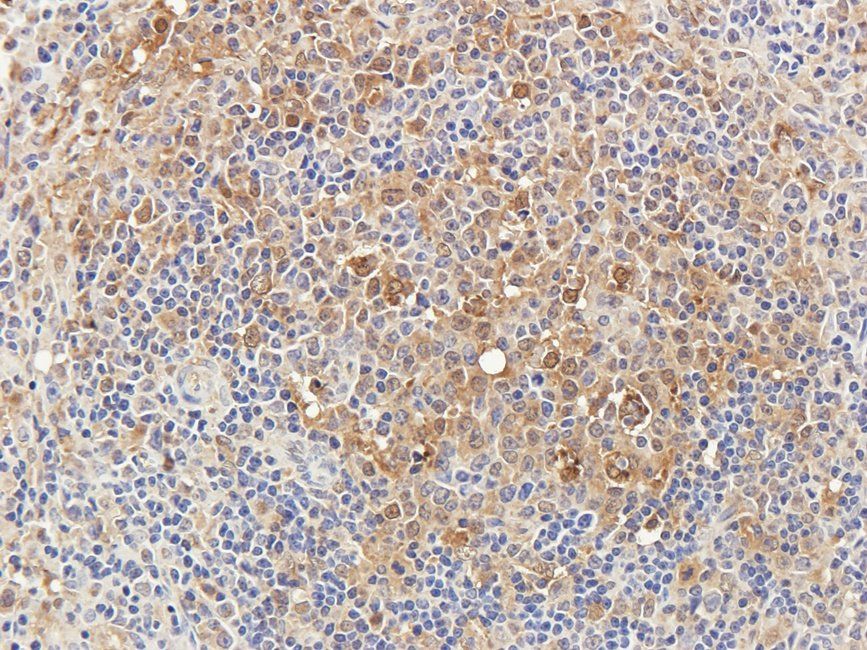 SRBP2 antibody