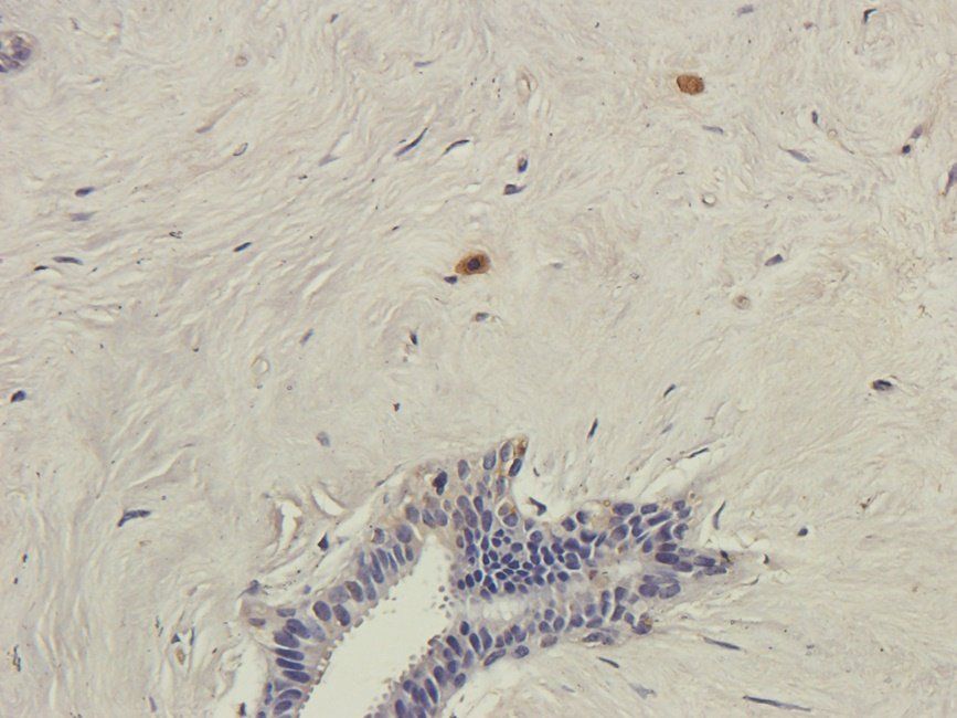 SRBP2 antibody